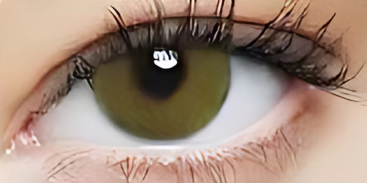 Eye Dia Conventional - S. Brown